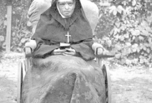 Zuster Longina verbrand in het aangezicht, 1915.