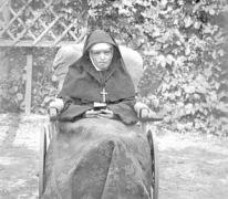 Zuster Longina verbrand in het aangezicht, 1915.