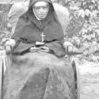 Zuster Longina verbrand in het aangezicht, 1915.